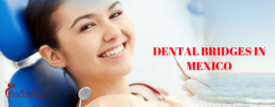 Dental Bridges in Mexico